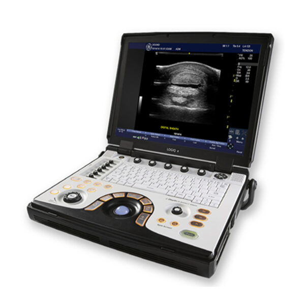 GE Logiq e Portable Ultrasound