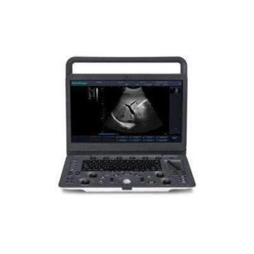 SonoScape E1 Portable Ultrasound