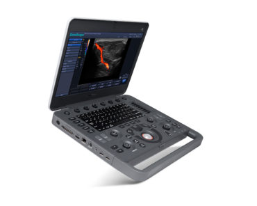 SonoScape X5 Portable Ultrasound