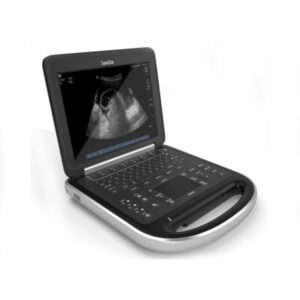 Sonosite Edge Portable Ultrasound
