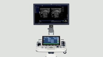 GE Logiq P9 POC Ultrasound