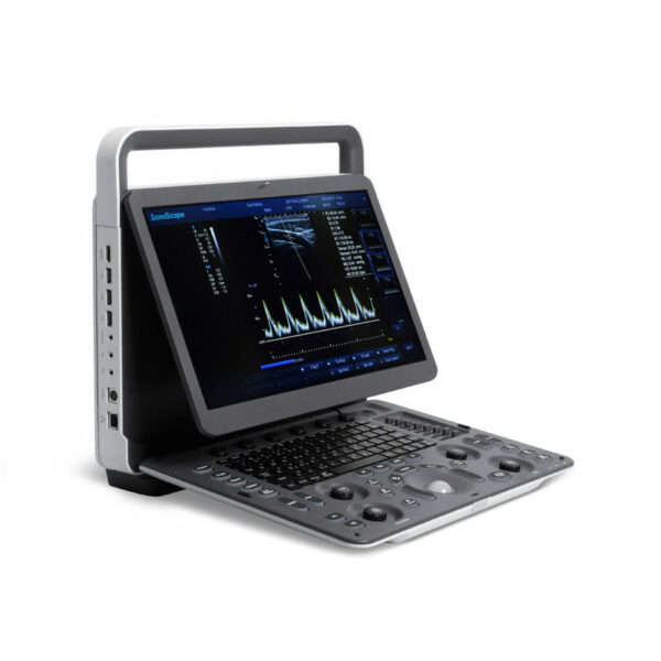 SonoScape E1 Portable Ultrasound