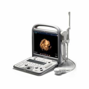 SonoScape S8 Portable Ultrasound